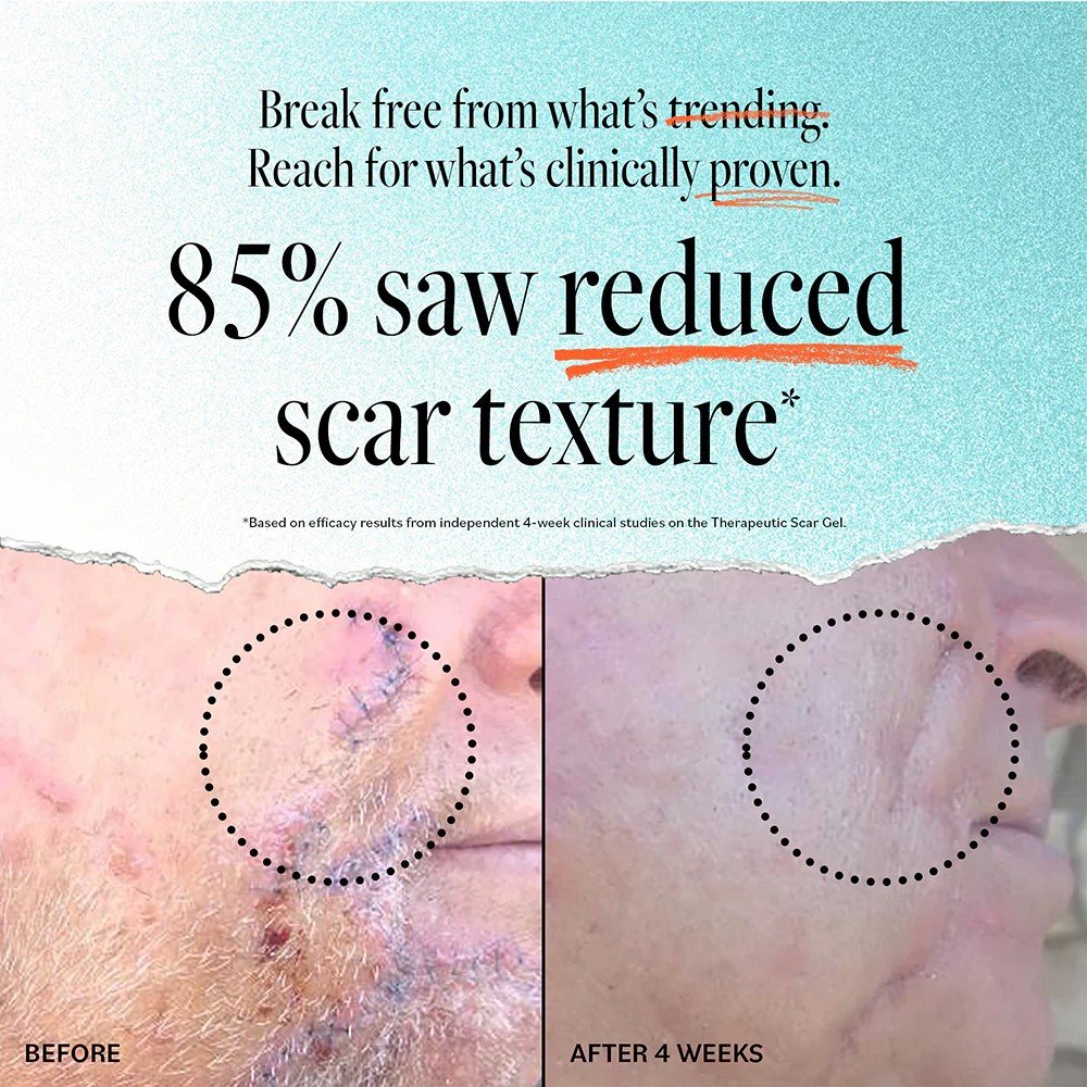 Derma-E Scar Gel 2 oz Gel